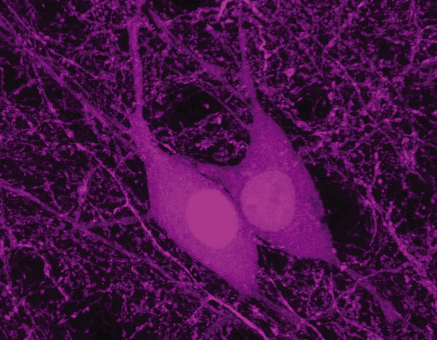 Acetylcholine Wakes Silent Neural Network